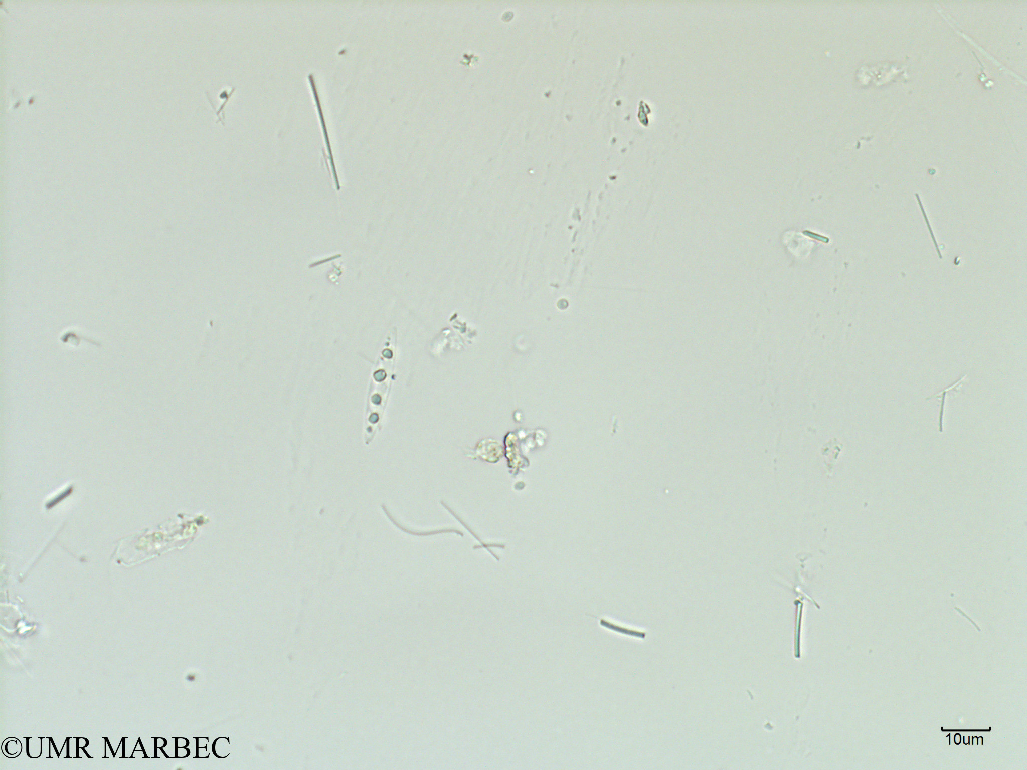 phyto/Scattered_Islands/iles_glorieuses/SIREME May 2016/Pennée spp 3-5x15-40µm (SIREME-Glorieuses2016-GLO6surf-271016-pennée moy)(copy).jpg